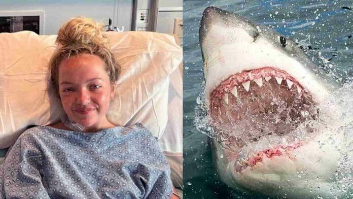 Teenage girl survives shark attack