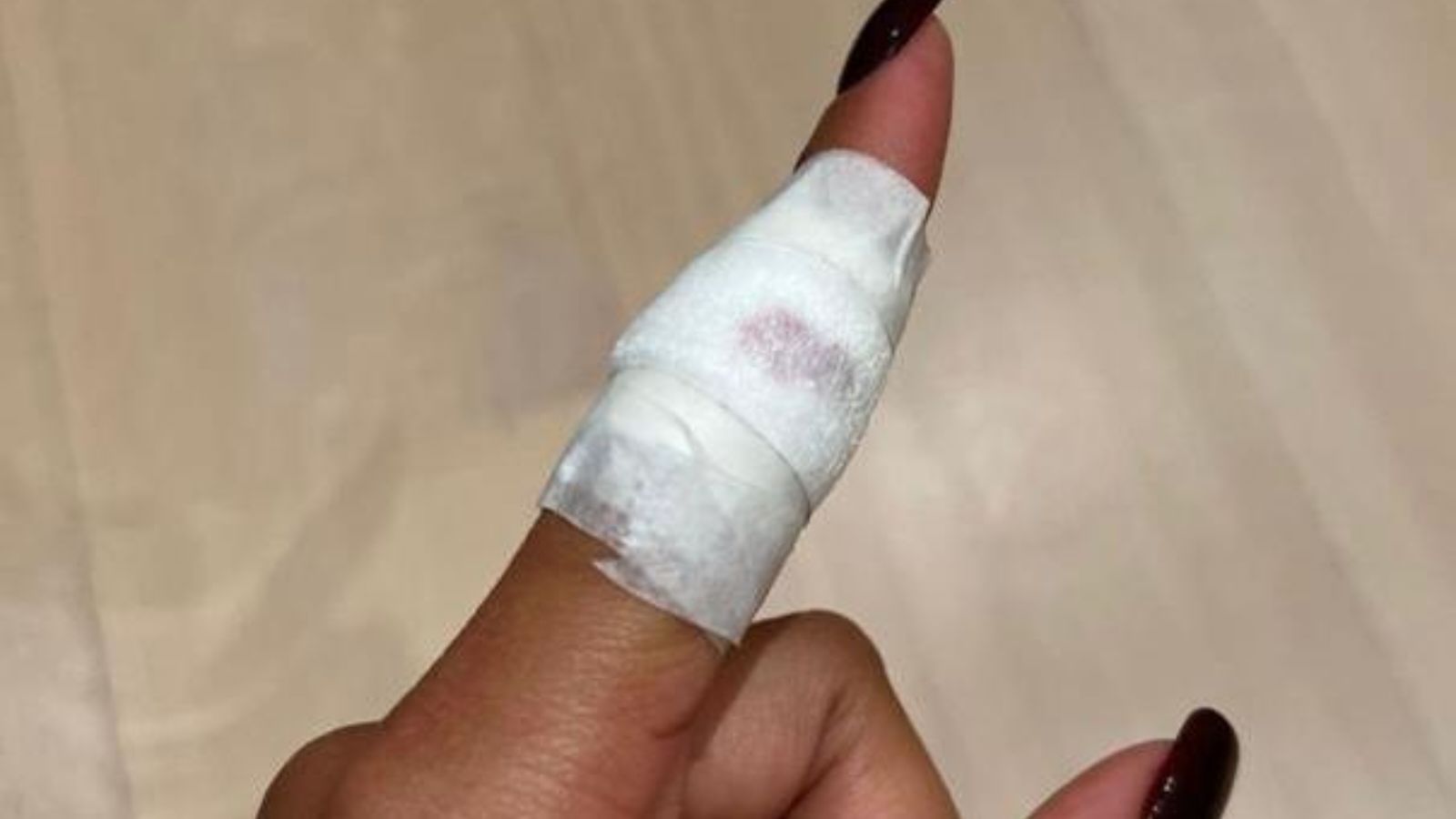 Zendaya injures her finger in a recent accident