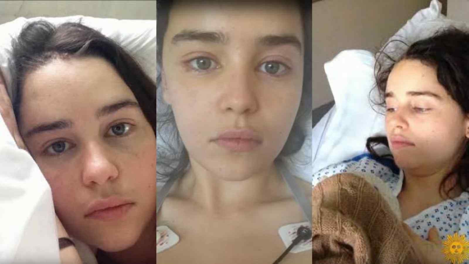 Emilia Clarke shares pictures of her time battling with Brain Aneurysm