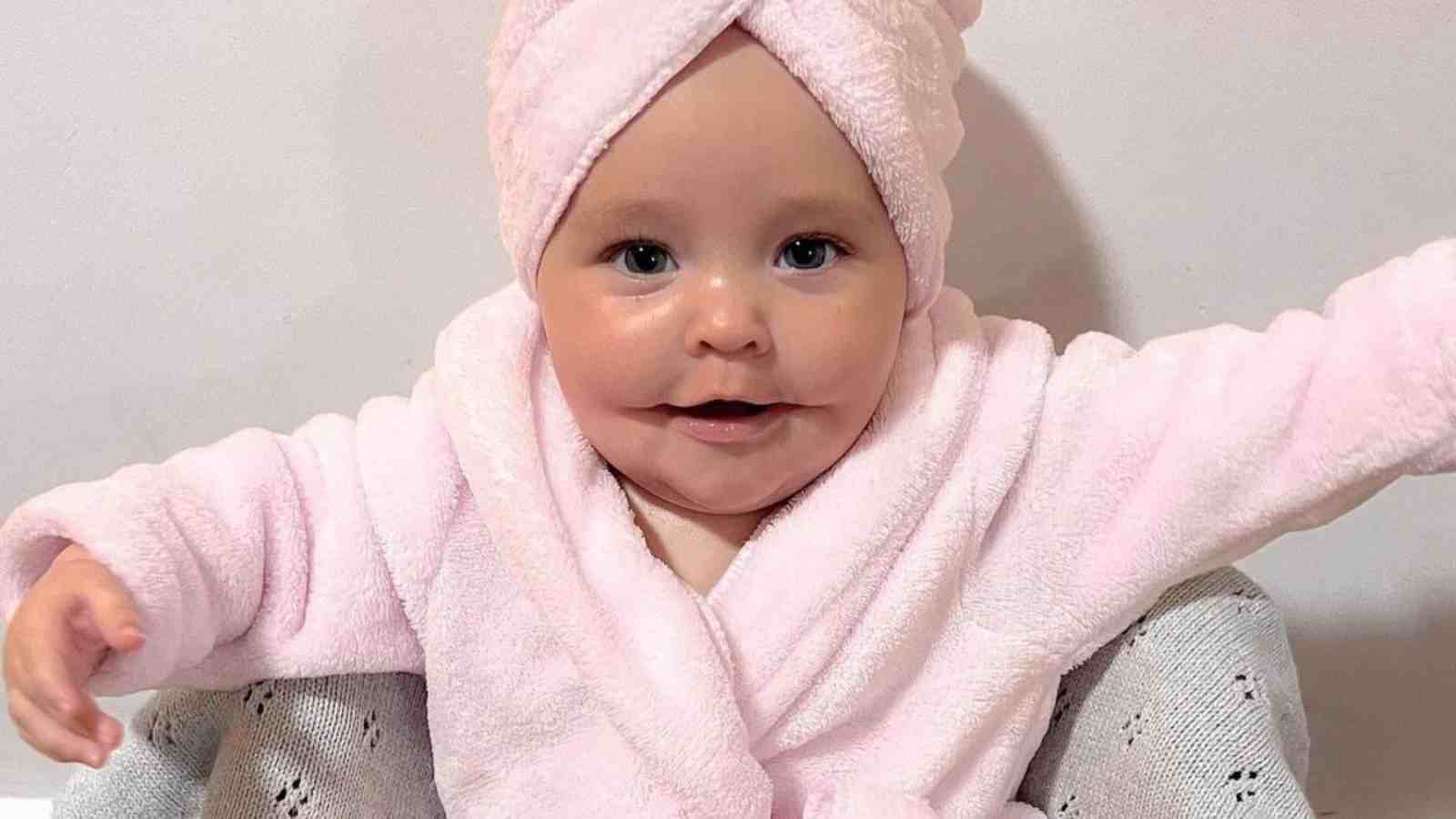 Baby Born With 'Permanent Smile' Condition Becomes Social Media Star