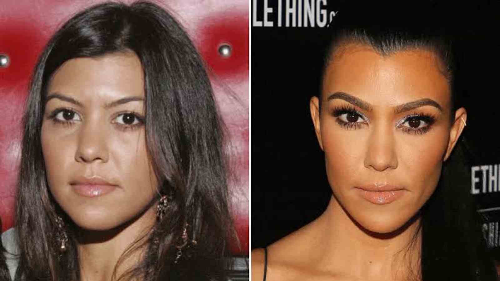 Kardashian-Jenner Sisters: Who Has Had The Most Plastic Surgery? -  Firstcuriosity