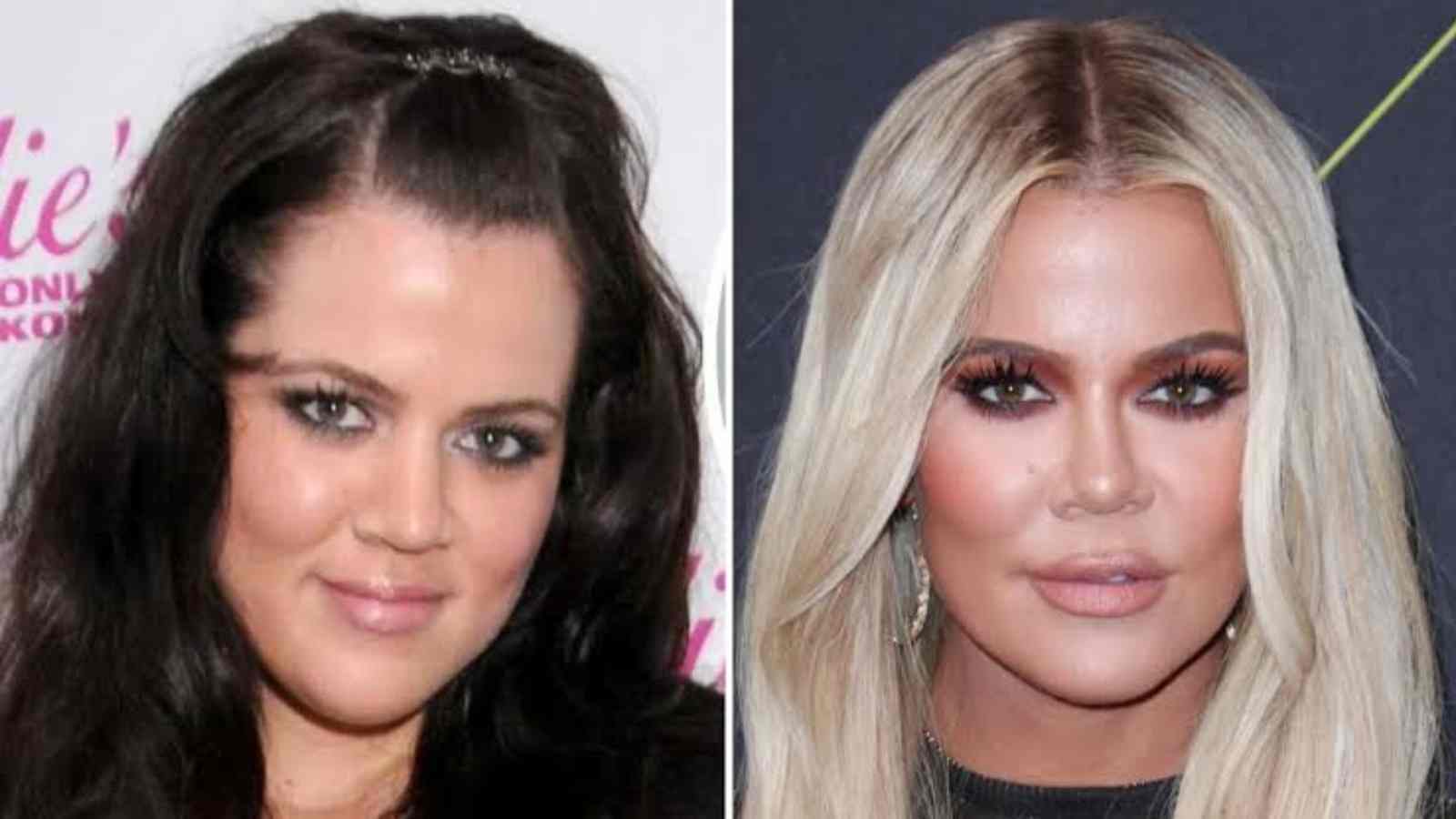 Kardashian-Jenner Sisters: Who Has Had The Most Plastic Surgery? -  Firstcuriosity