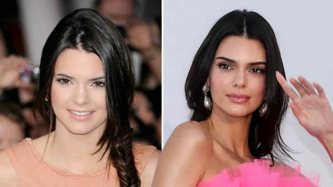 Kardashian-Jenner Sisters: Who Has Had The Most Plastic Surgery?