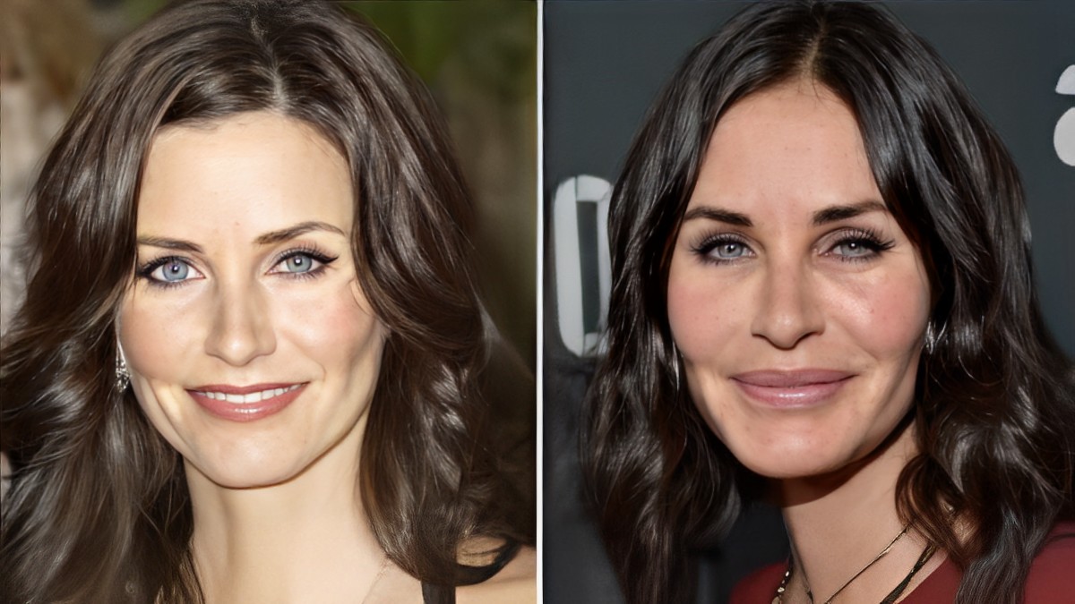 Top 10 Worst Celebrity Plastic Surgery Fails of All Time