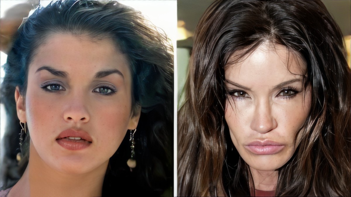 Top 10 Worst Celebrity Plastic Surgery Fails of All Time