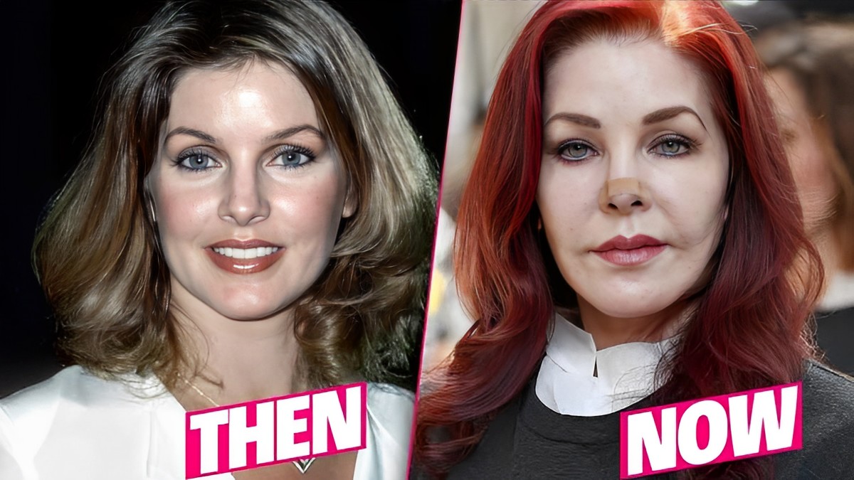 Top 10 Worst Celebrity Plastic Surgery Fails of All Time