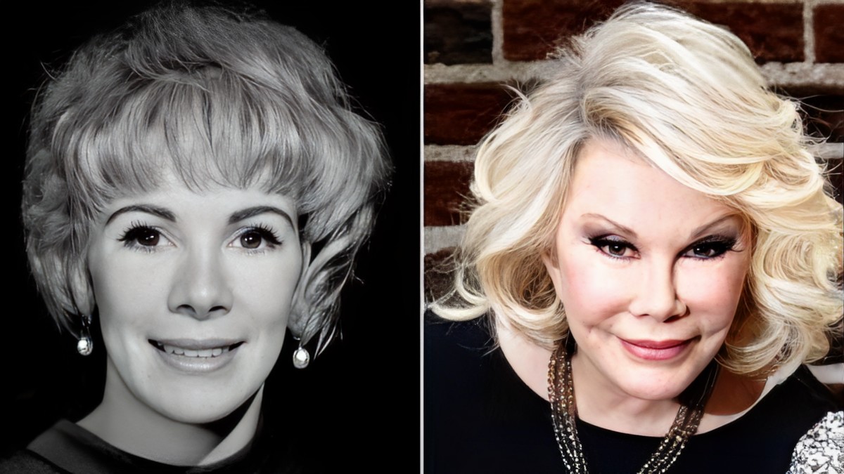 Top 10 Worst Celebrity Plastic Surgery Fails of All Time