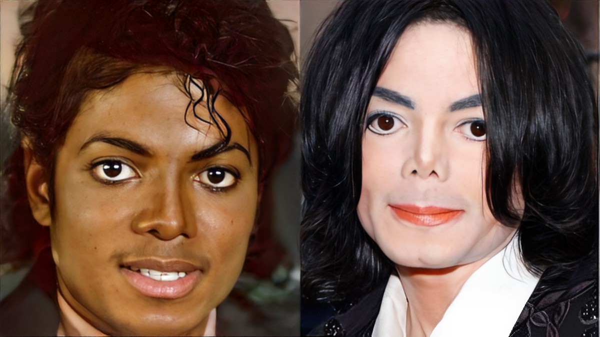 Top 10 Worst Celebrity Plastic Surgery Fails of All Time