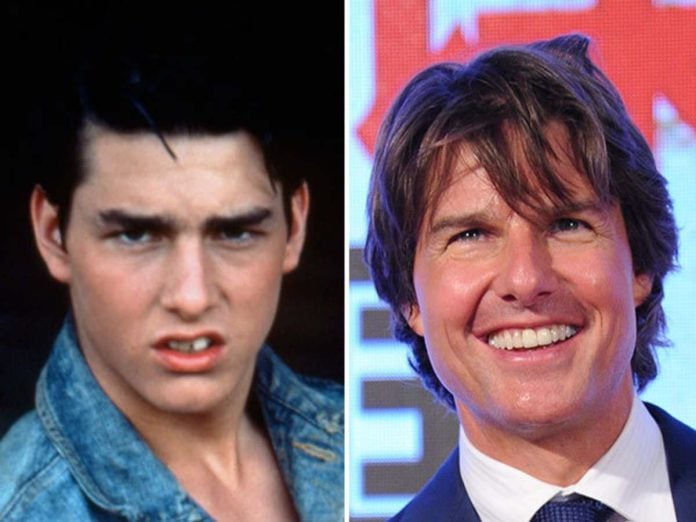 Tom Cruise Teeth Before And After: When Did The Actor Fix His Teeth? - First Curiosity