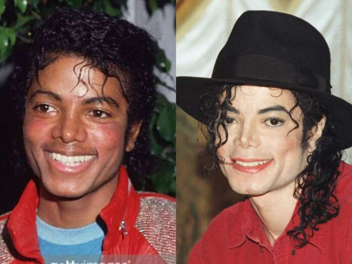 Left - Michael Jackson in 1980s, Right - Michael Jackson in 2005