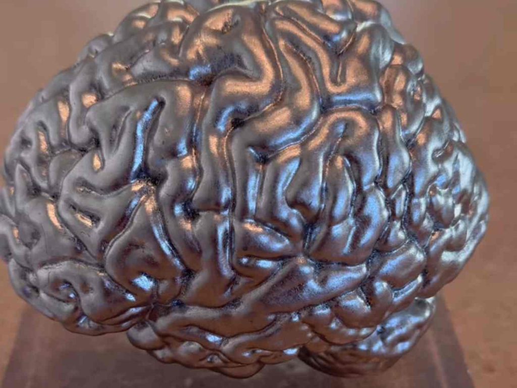 3D Model Of Kim Karashian’s Brain