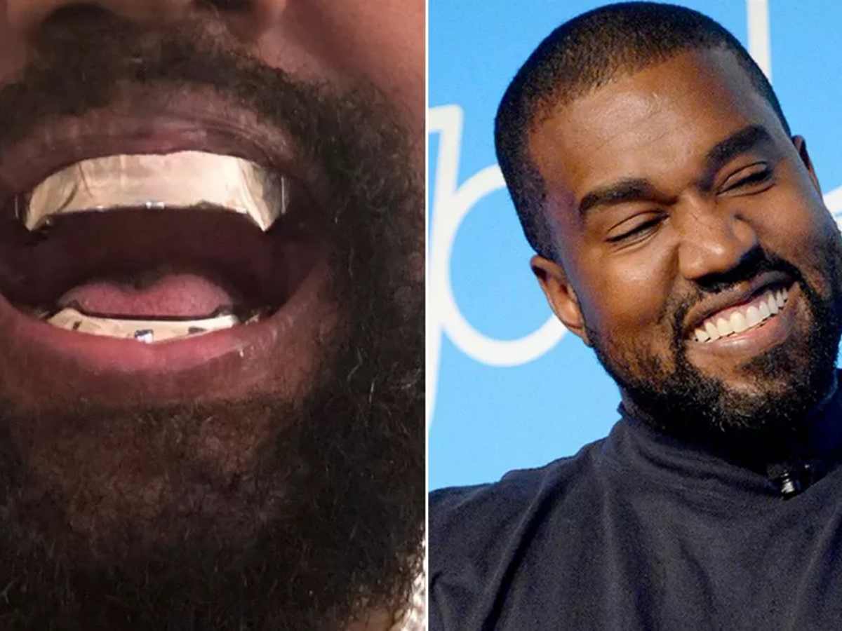 Kanye West’s $850,000 Titanium Smile Is Designed By Him And 'Father Of ...