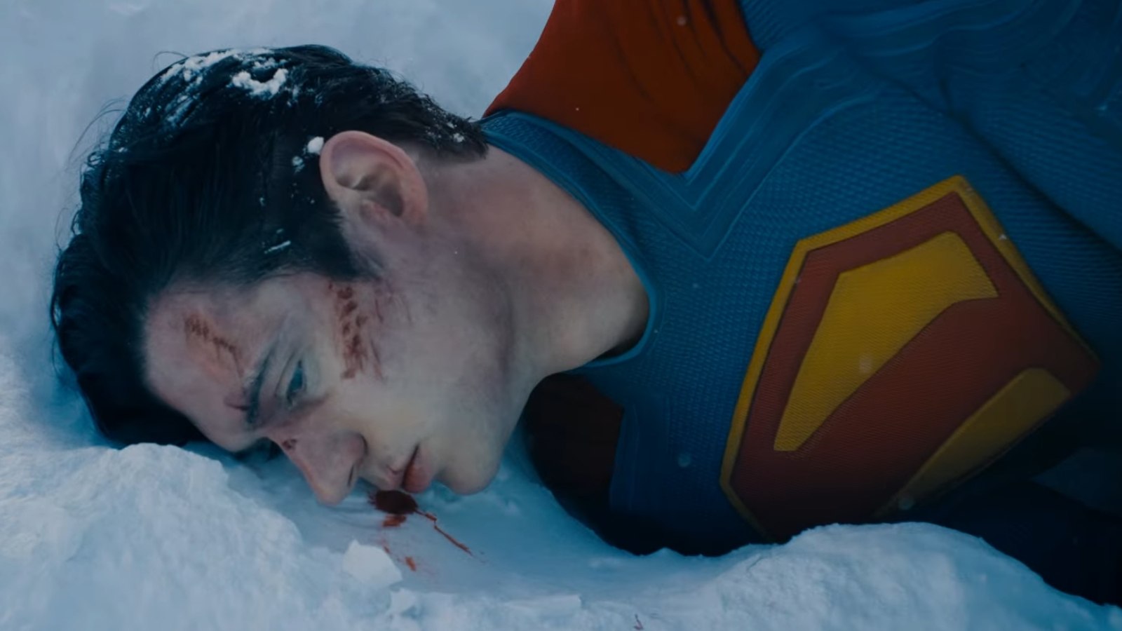 ‘Superman’ Trailer Opens With Bloodied And Bruised David Corenswet