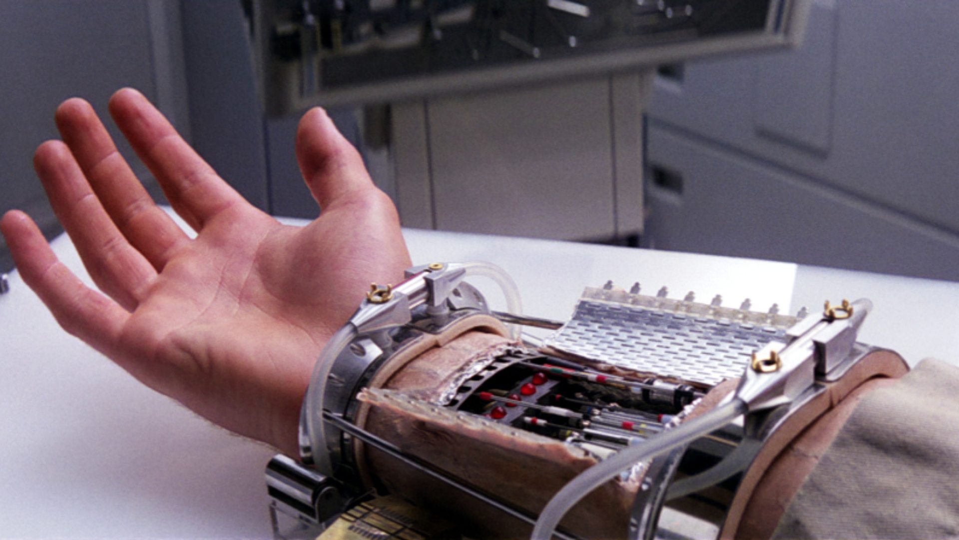 13. Bionic Limbs