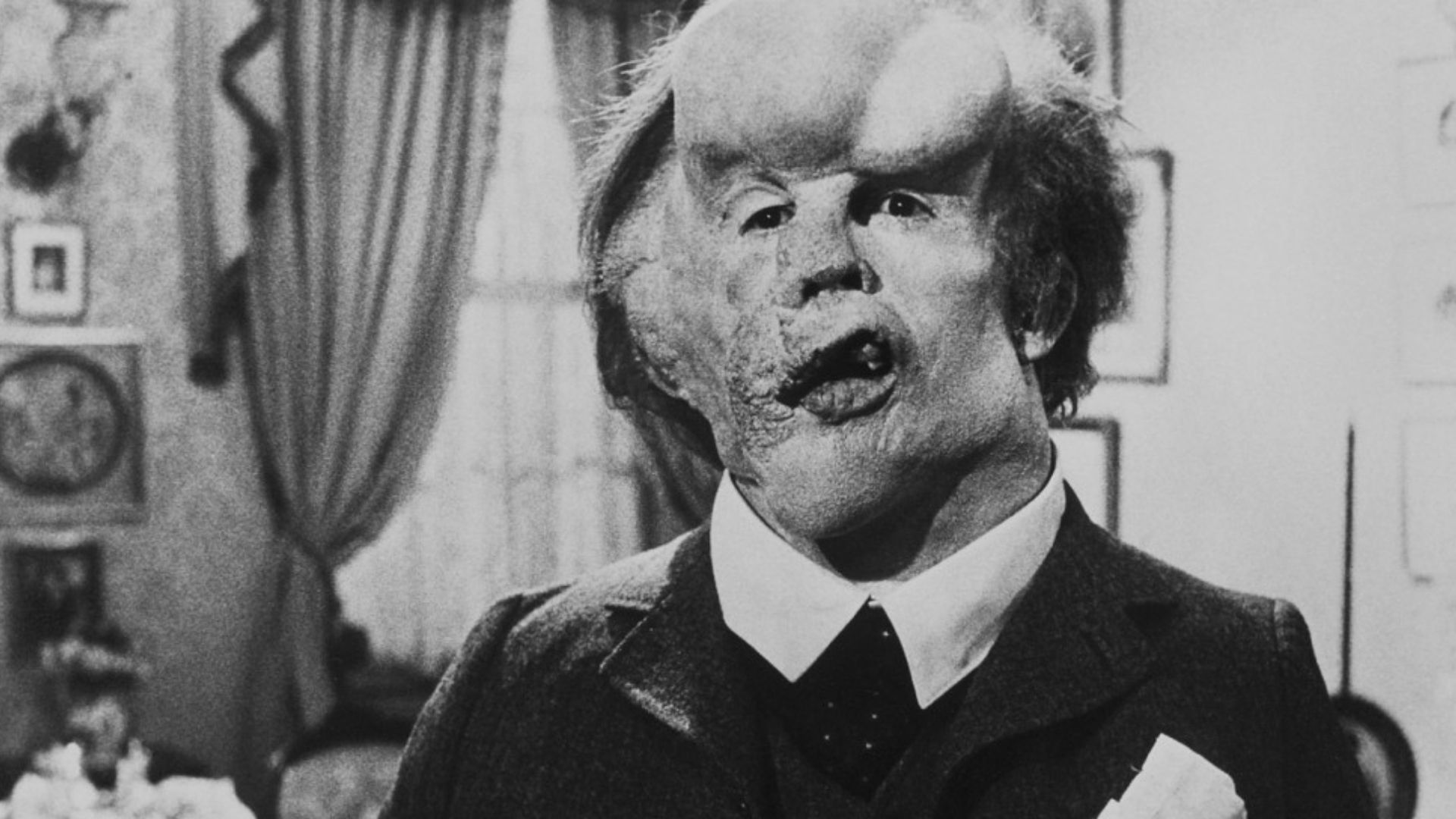 The Elephant Man (1980)